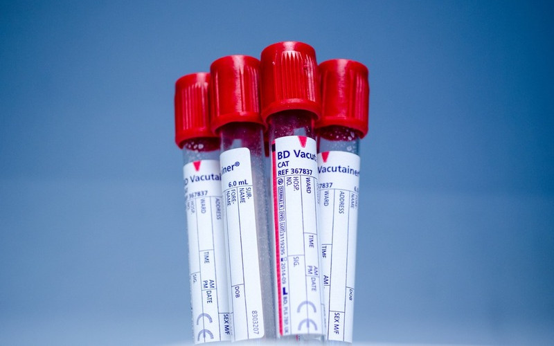 Dundee Rotary’s AMBA Screens Set for Saturday